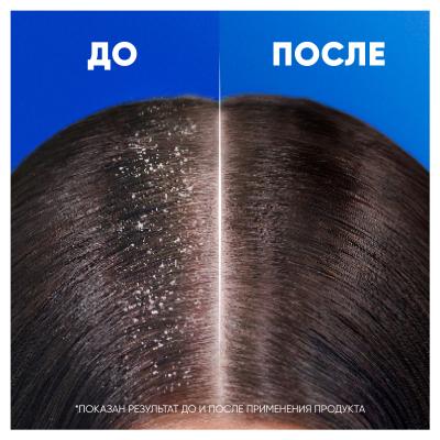 HEAD & SHOULDERS Шампунь и бальзам-ополаскиватель против перхоти 2в1 Ментол 360мл